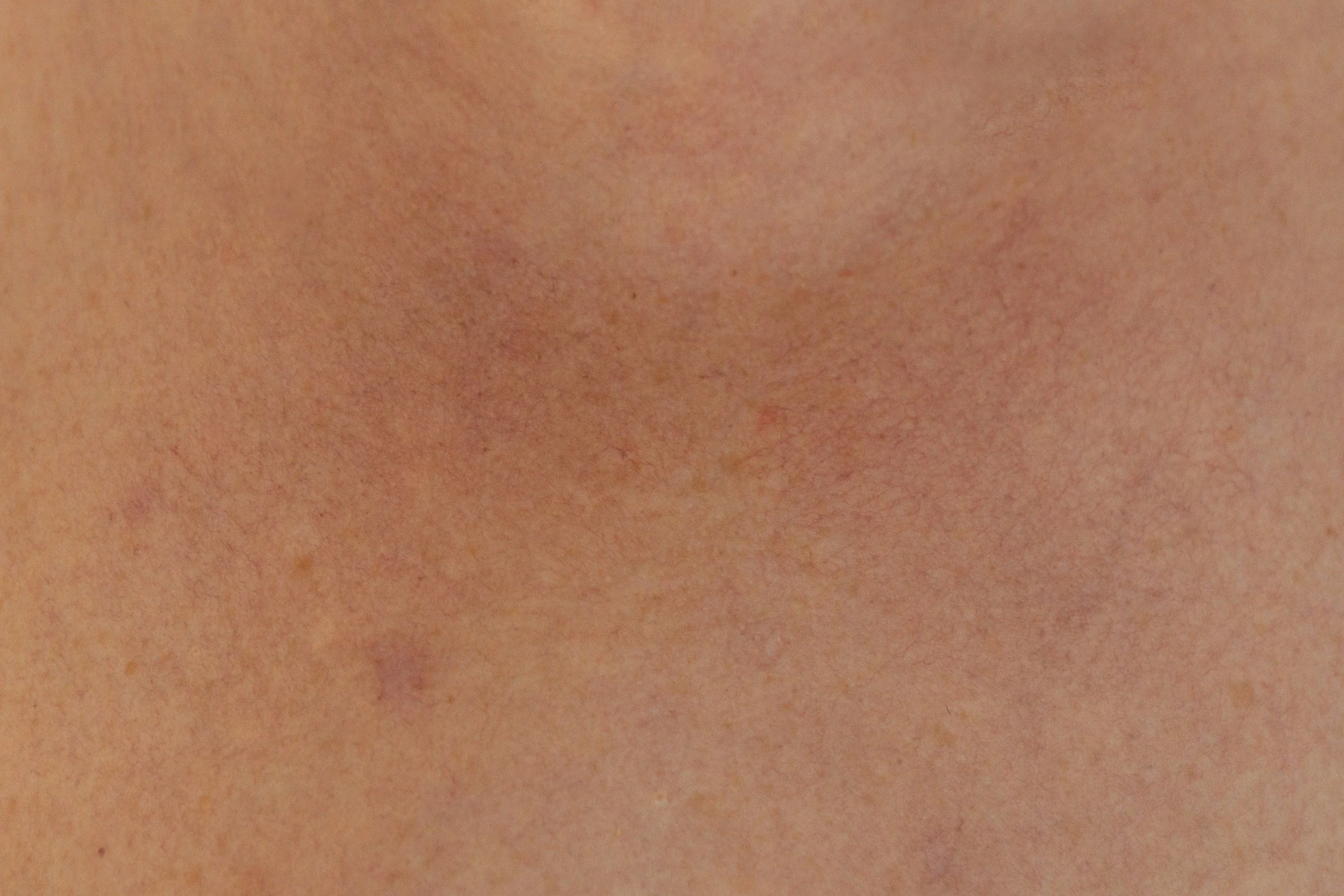 Dr Jen Law Plastic Surgeon Sydney Darlinghurst Chatswood Female North Shore Eastern Suburbs